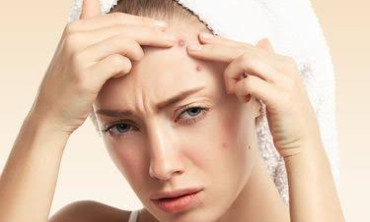 Jerawat Pecah? Tenang, Ini Cara Mengatasinya!